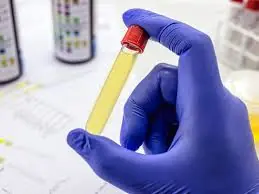 Portaria que obriga empresas a controlar exame toxicológico dos motoristas entra em vigor nesta 5ª