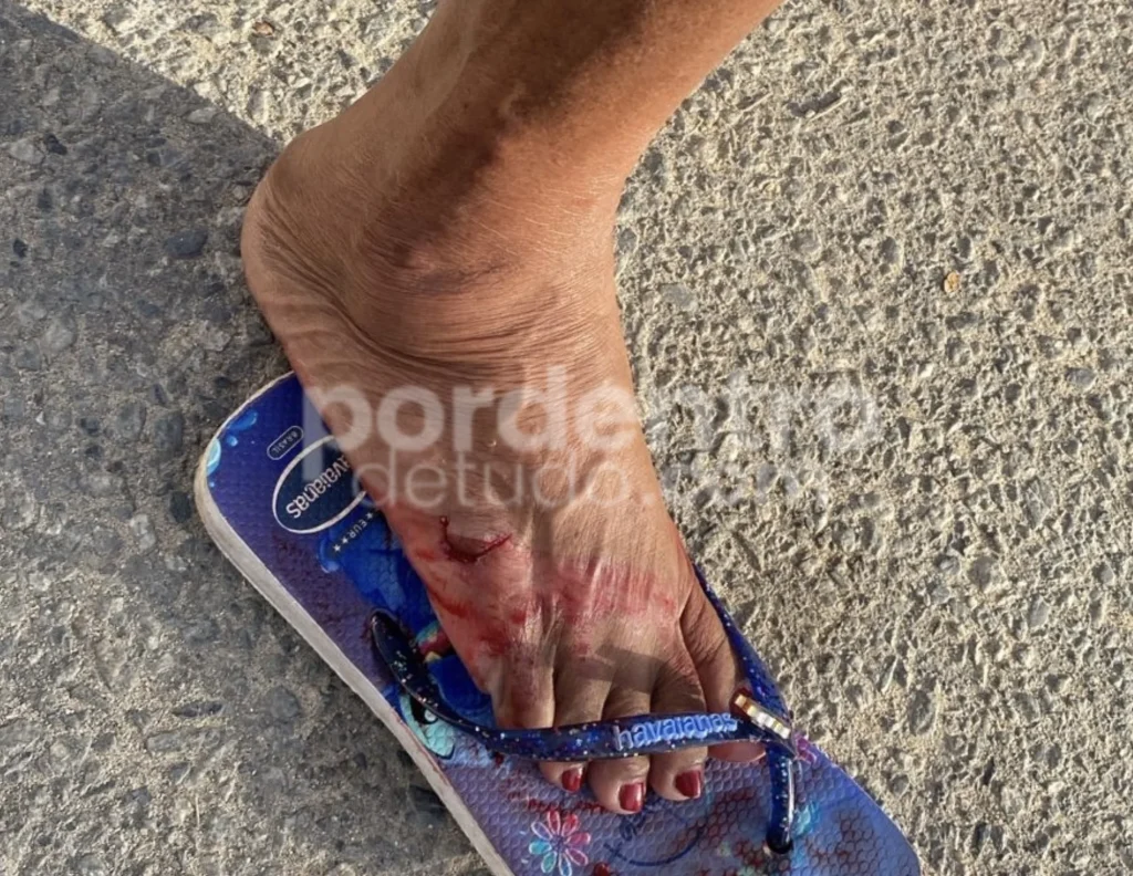 Cadela agressiva ataca moradores no bairro Vera Cruz em Pedro Leopoldo