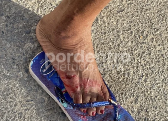 Cadela agressiva ataca moradores no bairro Vera Cruz em Pedro Leopoldo