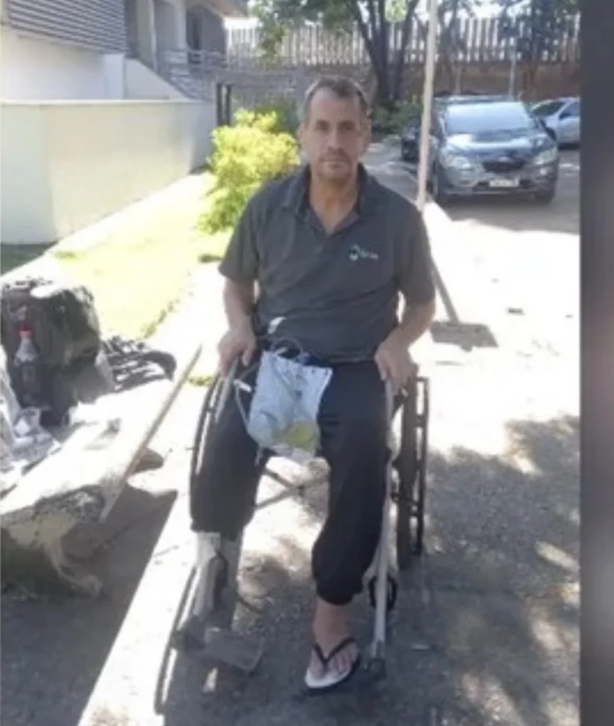 Morador do bairro Progresso em Matozinhos cria vaquinha para compra de prótese após acidente