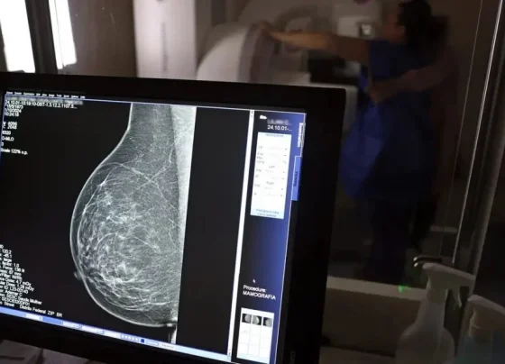 70 exames realizados e fila de 1.300 mulheres: Pedro Leopoldo amplia acesso à mamografia