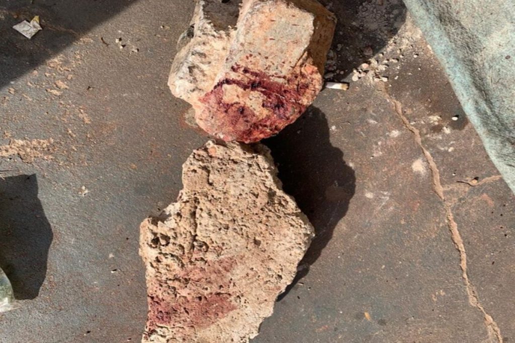 Homem é atingido na cabeça com pedrada e caso é investigado em Matozinhos